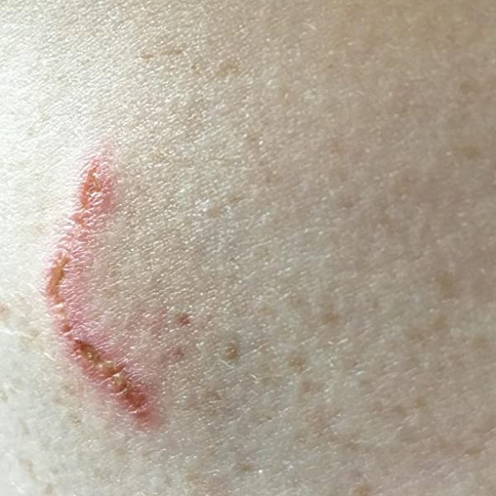 Bio Oil - Picture 4 of 10